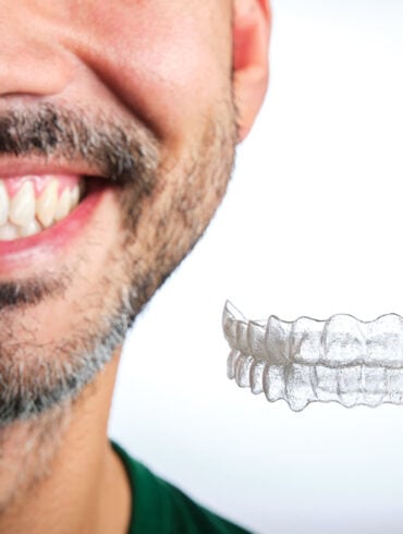 man with transparent dental retainer